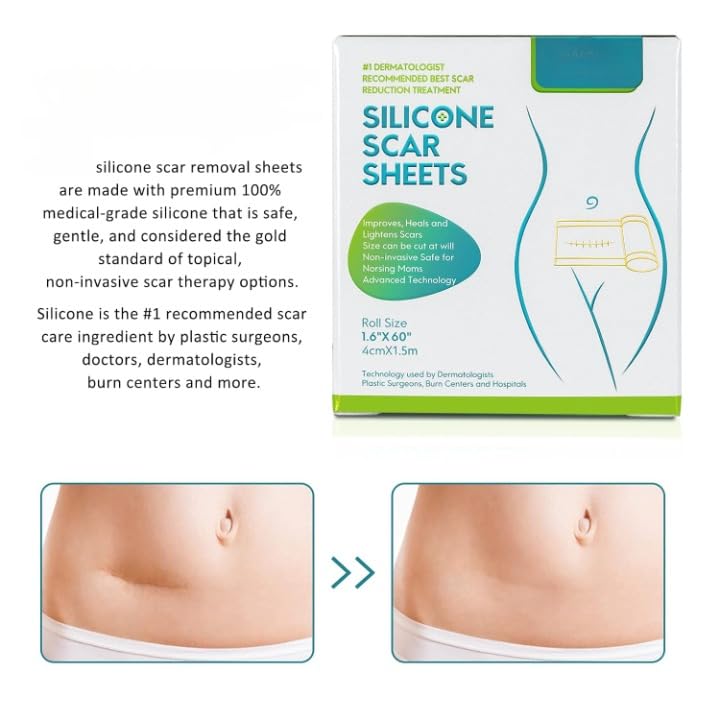 Silicone Scar Sheets Soft Scar Tape for Scars Removal
