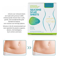 Silicone Scar Sheets Soft Scar Tape for Scars Removal